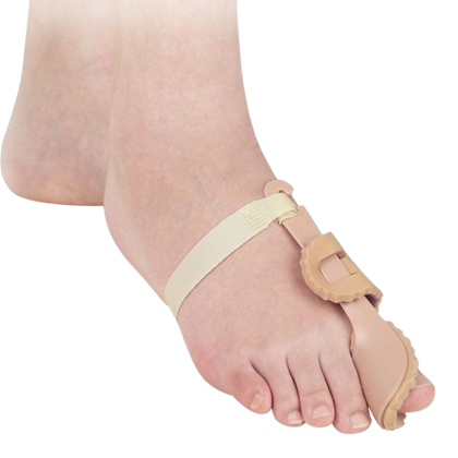 Traditional Rigid Splints